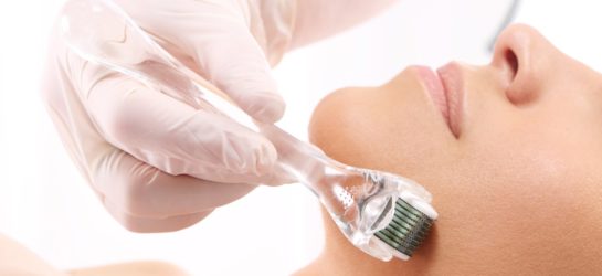 Microneedling