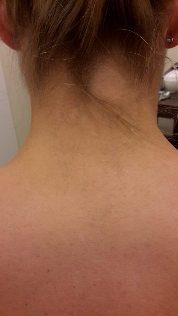Haut Betäubungscreme Tattoo