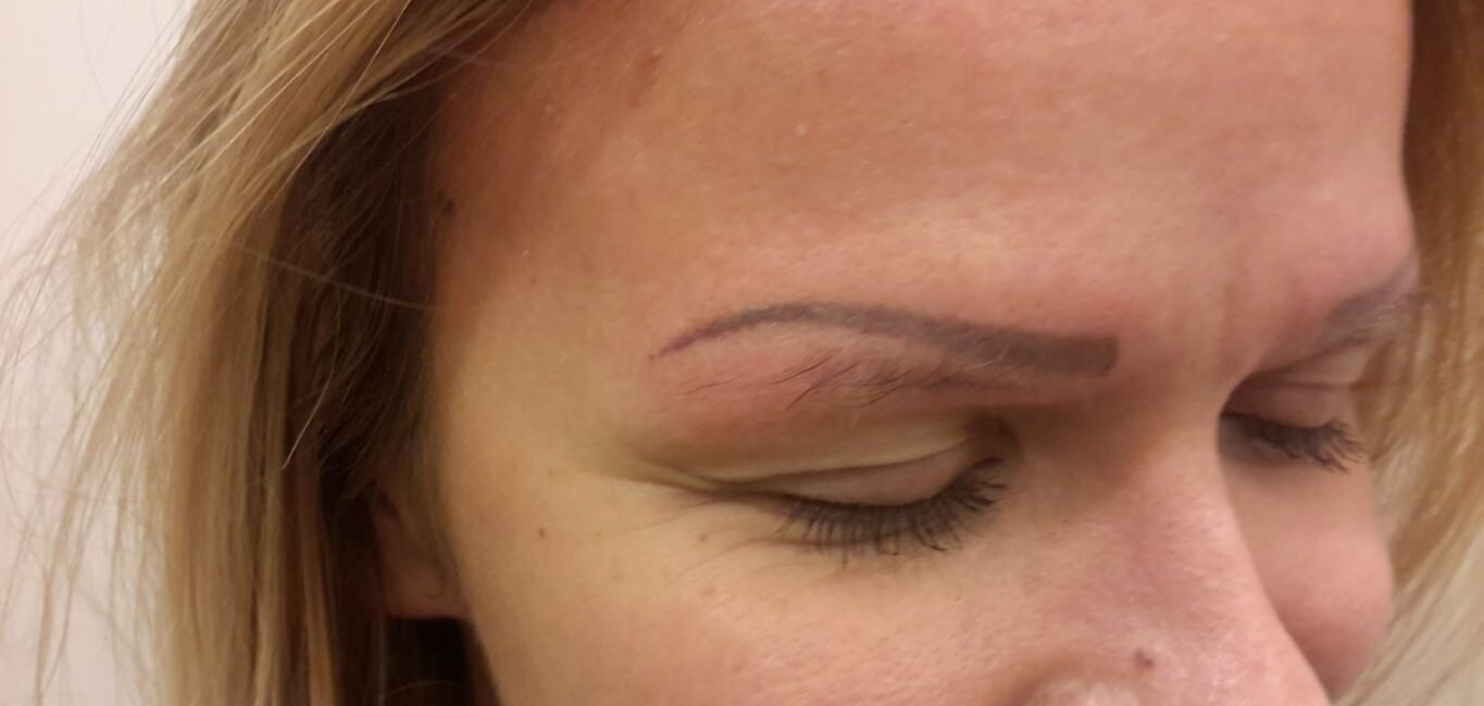 Permanent Make Up Removal In Vienna With Laser