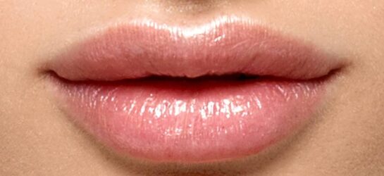 Lippen Aufspritzen
