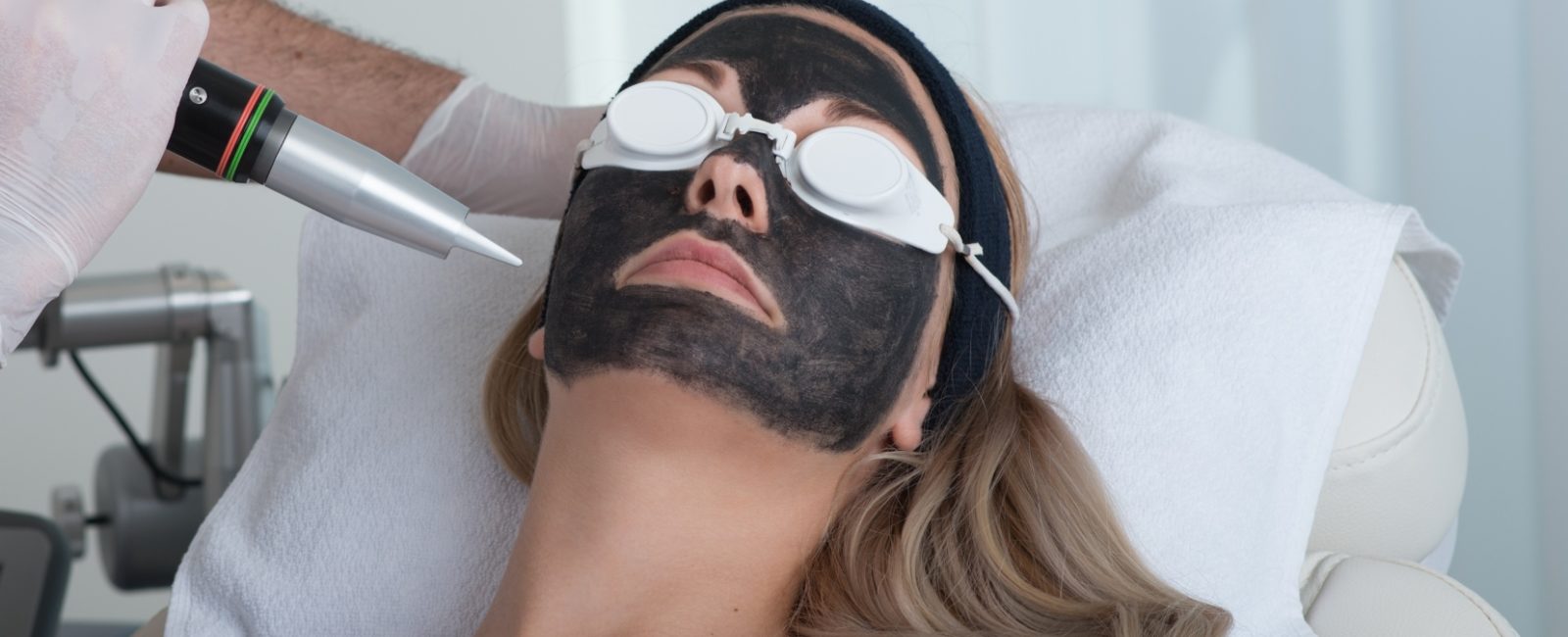 Reborn Carbon Laser Peeling bei Dermacare