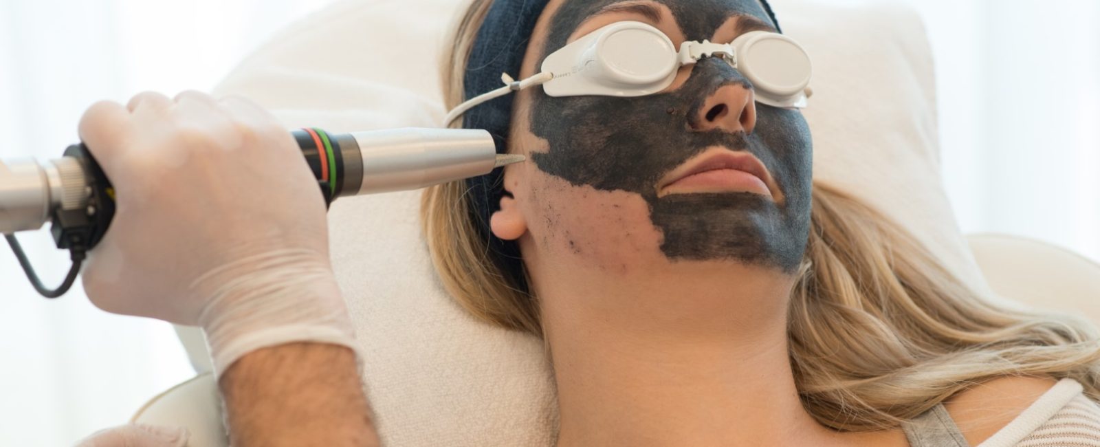 Reborn Carbon Laser Peeling: Kosmetik Behandlungen bei Dermacare