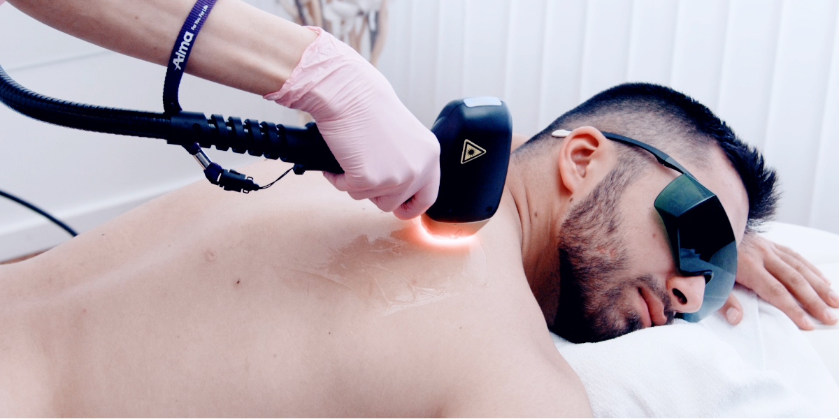 Auf dem Bild ist ein Patient zu sehen, der im Dermacare Institut eine Laser Haarentfernung in Wien erhält. Der Mann liegt entspannt auf einer Behandlungsliege, während eine Fachkraft mit modernster Technologie eine Körperenthaarung bei Dermacare an seinem Rücken durchführt. Der Laser wird präzise über die Haut geführt, und der Patient trägt eine Schutzbrille, um seine Augen vor dem Laserlicht zu schützen. Dank der schonenden SHR-Technologie wird die Behandlung nahezu schmerzfrei durchgeführt, was zu einem angenehmen Erlebnis für den Patienten führt. Diese Methode ist besonders effektiv und ermöglicht langfristig glatte Haut ohne unerwünschte Behaarung.