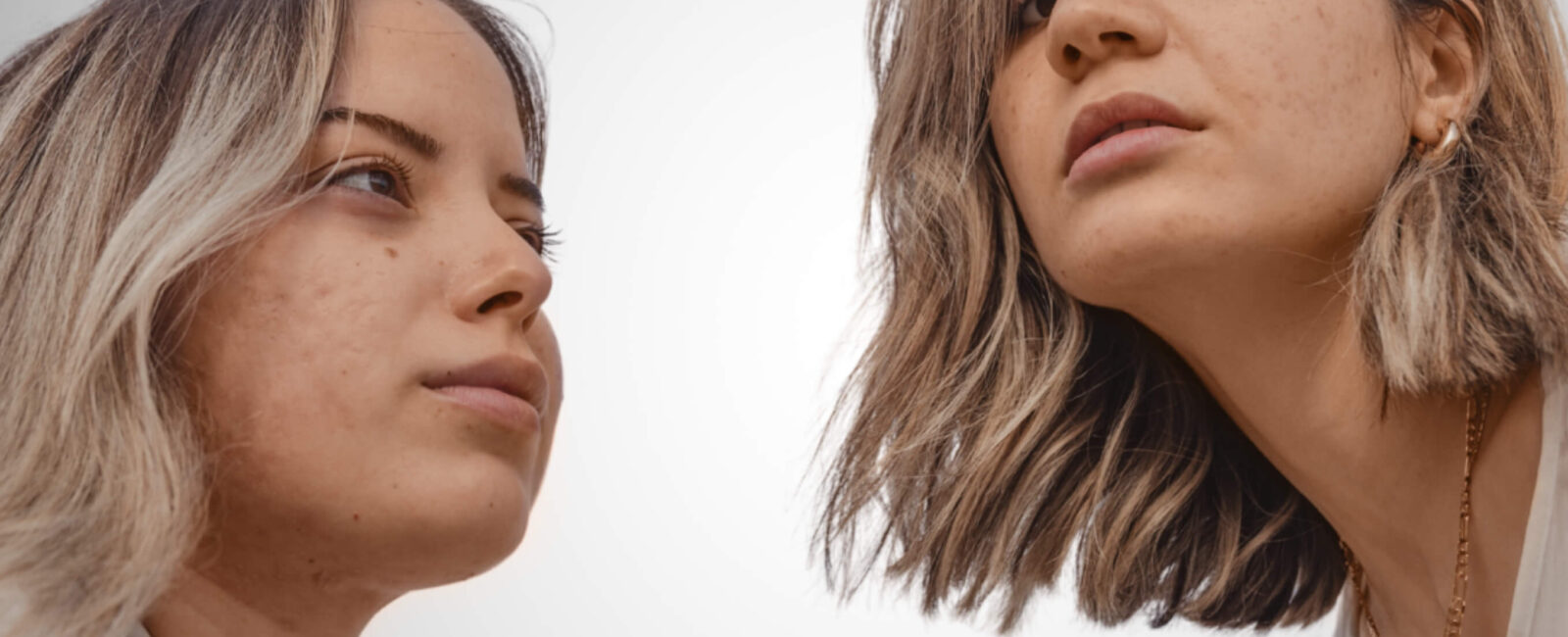 auf dem Bild sieht man zwei frauen die Probleme mit ihrer haut haben. Es sind Aknenarben sichtbar. jetzt wenden sie sich an Dermacare für Microneedling bei Akne.