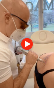 Auf dem Bild ist eine Laser Tattooentfernung von Dermacare Wien zu sehen. Einer Frau wird gerade ein Rückentattoo entfern.