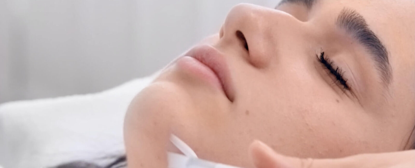 Auf dem bild ist eine Frau sichtbar die sich ihre Aknenarben behandeln lässt. sie ist bei Dermacare Wien und bekommt ein Peeling.