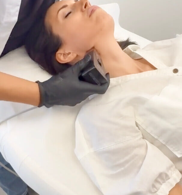 Hier sieht man die Tammy wie sie eine Microneedling Behandlung erhaltet. Dermacares Hightech gegen Falten.