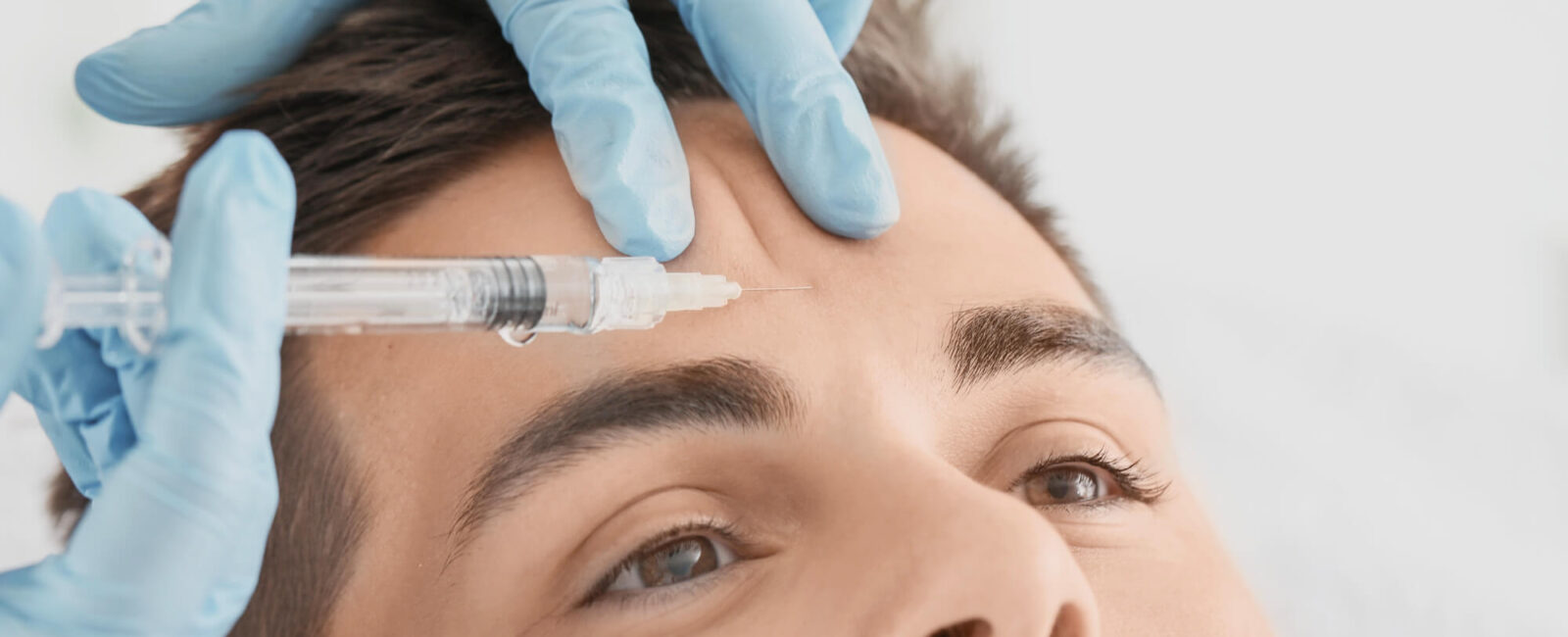 Hier ist ein Mann zu sehen der in seine Stirn eine Methode zur Faltenunterspritzung bekommt. Die Botox Therapie ist eine Anti-Aging Behandlung von Dermacare Wien.