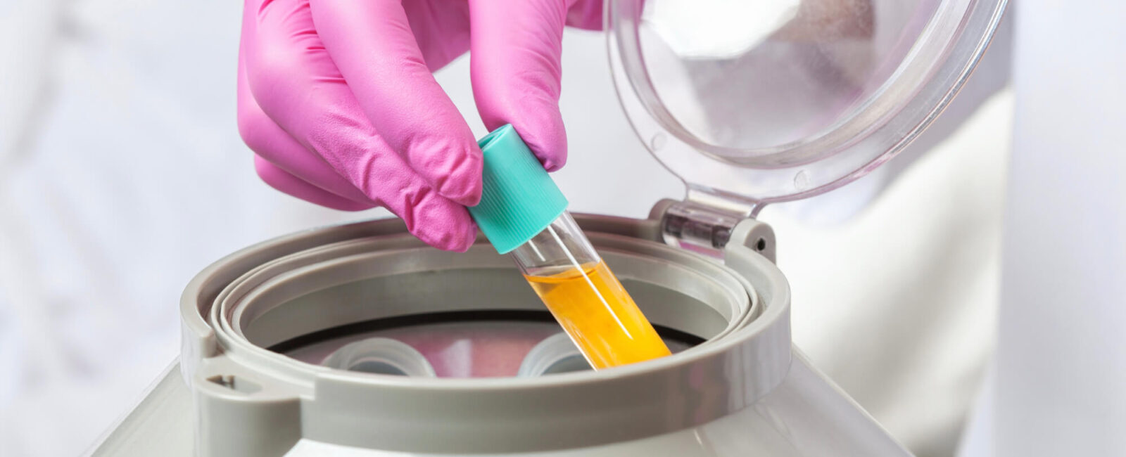 Hier sieht man Tools und Substanzen für die PRP Therapie, eine Anti-Aging Behandlung von Dermacare Wien.