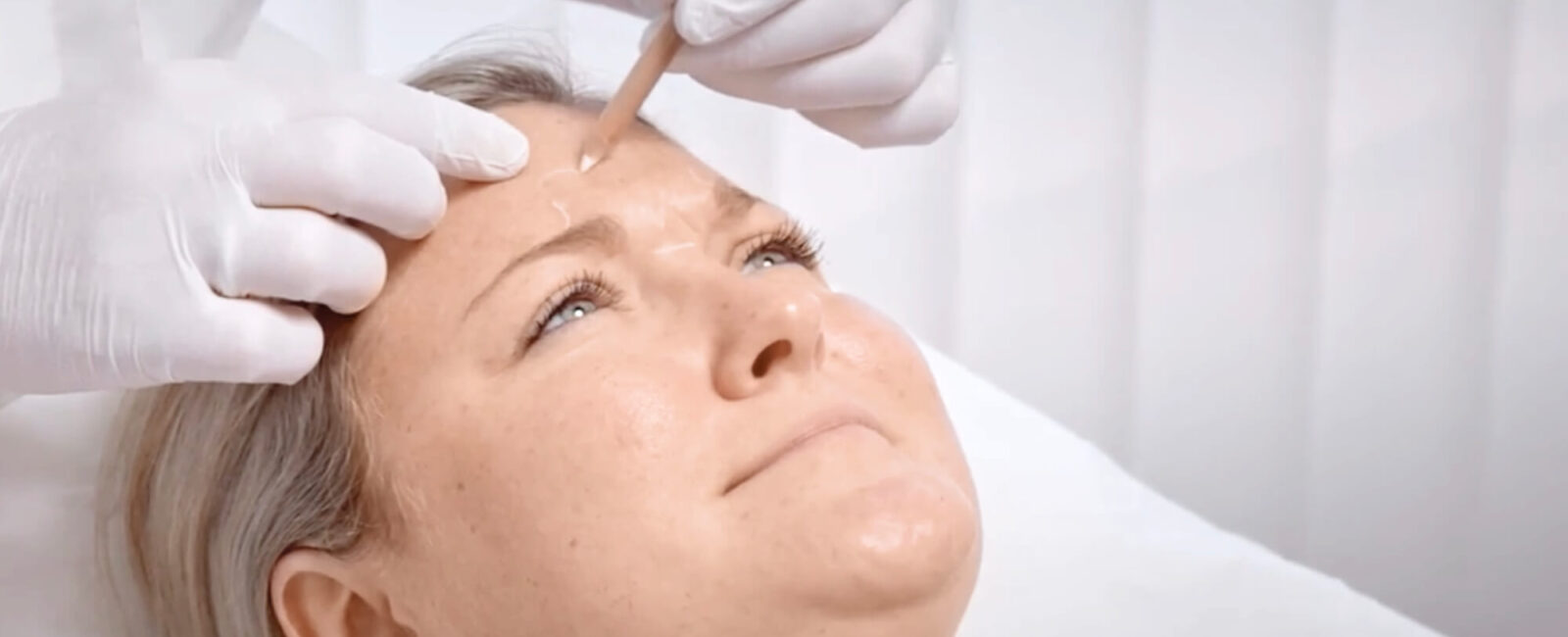 Botox im Gesicht: Die besten Zonen für Faltenunterspritzung mit Botox Auf dem Bild werden der Frau gerade die wichtigsten Behandlungsregionen im Gesicht für die Faltenunterspritzung mit Botox eingezeichnet. Sie möchte ihre Stirnfalten glätten.