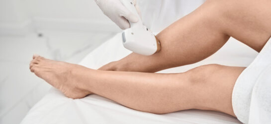 Nahaufnahme einer professionellen Laser-Haarentfernung an den Beinen in einer modernen Praxis. Die Behandlung wird präzise und schonend durchgeführt, um eine effektive dauerhafte Haarentfernung zu erzielen.