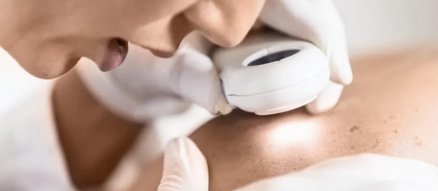 Auf dem Bild ist Dermacares neue Dermatologin in Wien zu sehen wie sie eine Hautkrebsvorsorge durchführt. Dr. Alica Píšteková untersucht mit einer speziellen Lupe ihre Patientin.