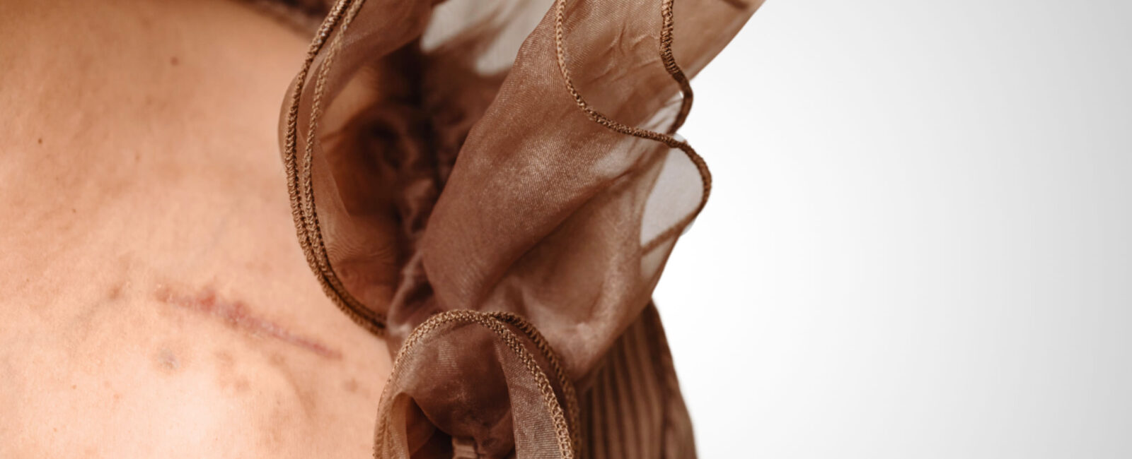 Tattoo über Narben – was Sie vorher wissen sollten Narbe auf der Schulter