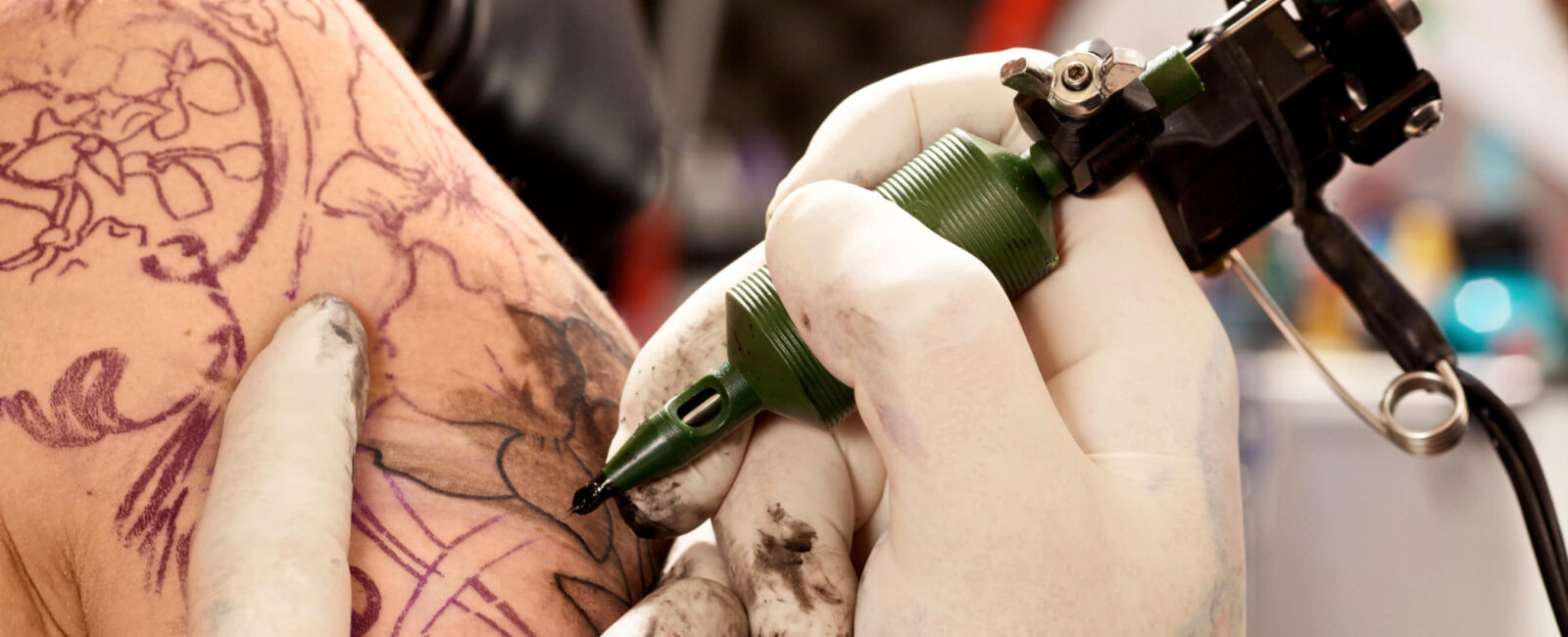 Hier sieht man wie eine PatientIn sich ein Tattoo über Narben stechen lässt. Auf Ihrer Schulter hat sie wohl einen unschönen Fleck der gerade mit eine schnörkeligen Muste überstochen wird.