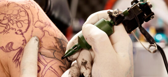 Hier sieht man wie eine PatientIn sich ein Tattoo über Narben stechen lässt. Auf Ihrer Schulter hat sie wohl einen unschönen Fleck der gerade mit eine schnörkeligen Muste überstochen wird.