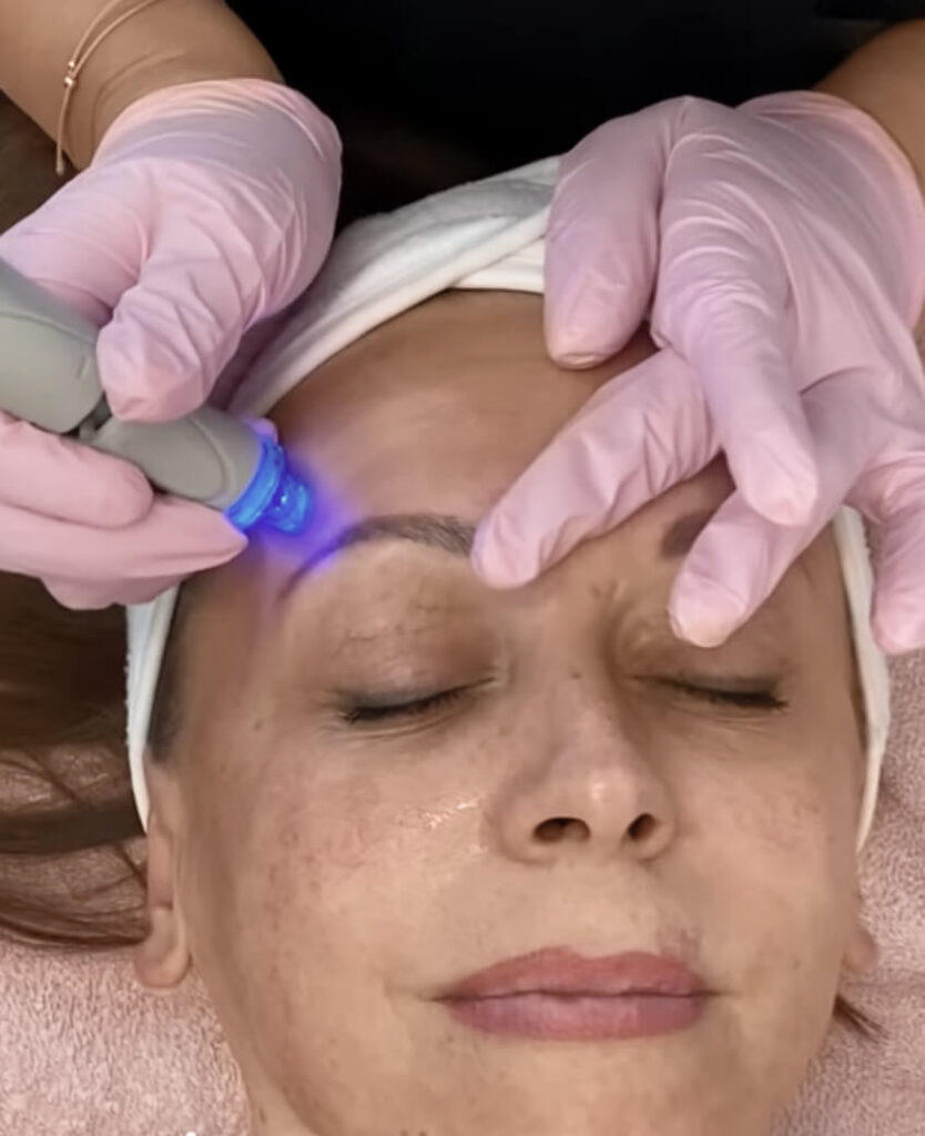 aquafacial behandlung glow up Ballsaison wien Botox. wien