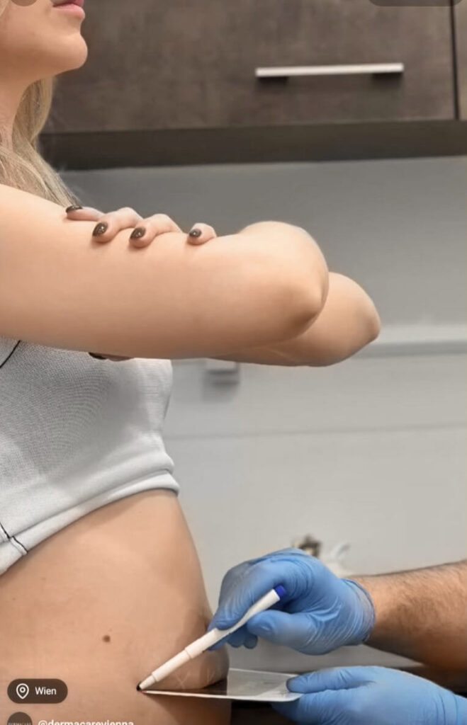 Auf dem Bild sieht man eine Frau, deren Bauch vermessen wird.